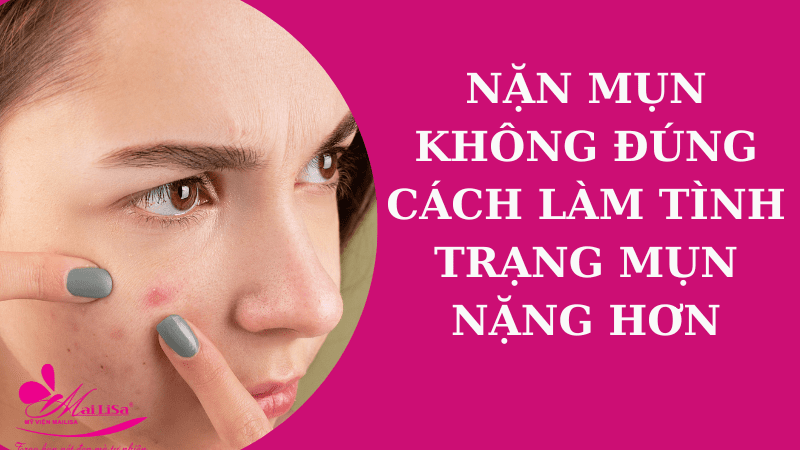 Bảng giá dịch vụ trị thâm mụn ở spa giá bao nhiêu 2022? nặn mụn không đúng cách gây mụn thâm nghiêm trọng