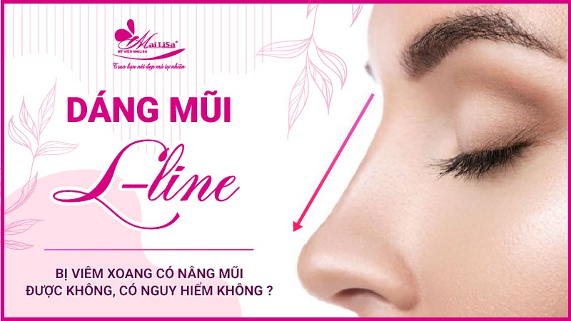 Bị viêm xoang có nâng mũi được không, có nguy hiểm không ? dáng mũi l line