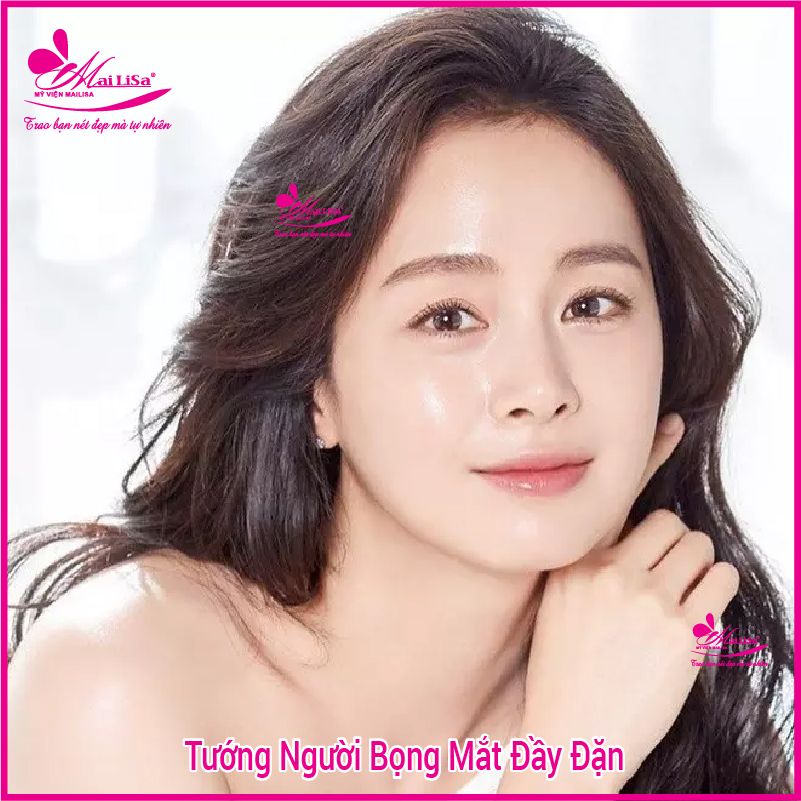 Người có bọng mắt to đẹp hay xấu? tướng số có tốt không? Xem tướng đàn ông có bọng mắt