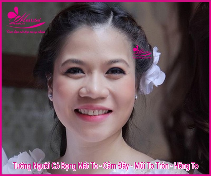 Người có bọng mắt to đẹp hay xấu? tướng số có tốt không? phụ nữ có phúc tướng