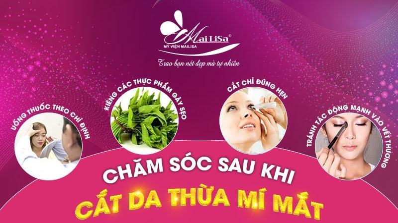 Có nên lấy mỡ mí mắt nội soi không và những điều cần tránh 17 - 17 lấy mỡ mí mắt nội soi lấy mỡ mí mắt nội soi