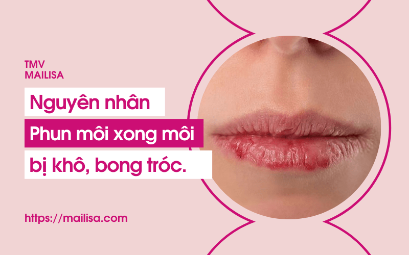 Phun môi bị khô bong tróc phải làm sao hết 2021 xăm môi xong bị khô nguyên nhân