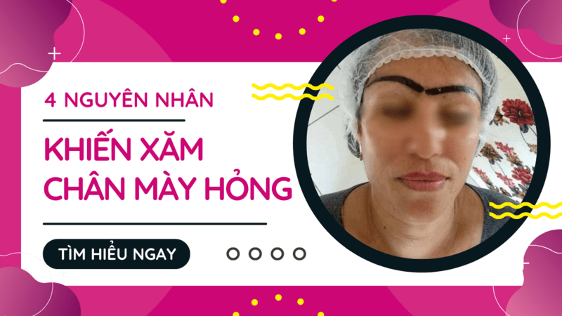Phun xăm lông mày, môi có ảnh hưởng gì không? Có hại không? Có nguy hiểm không? 4 nguyên nhân chính khiến xăm lông mày xấu, hỏng