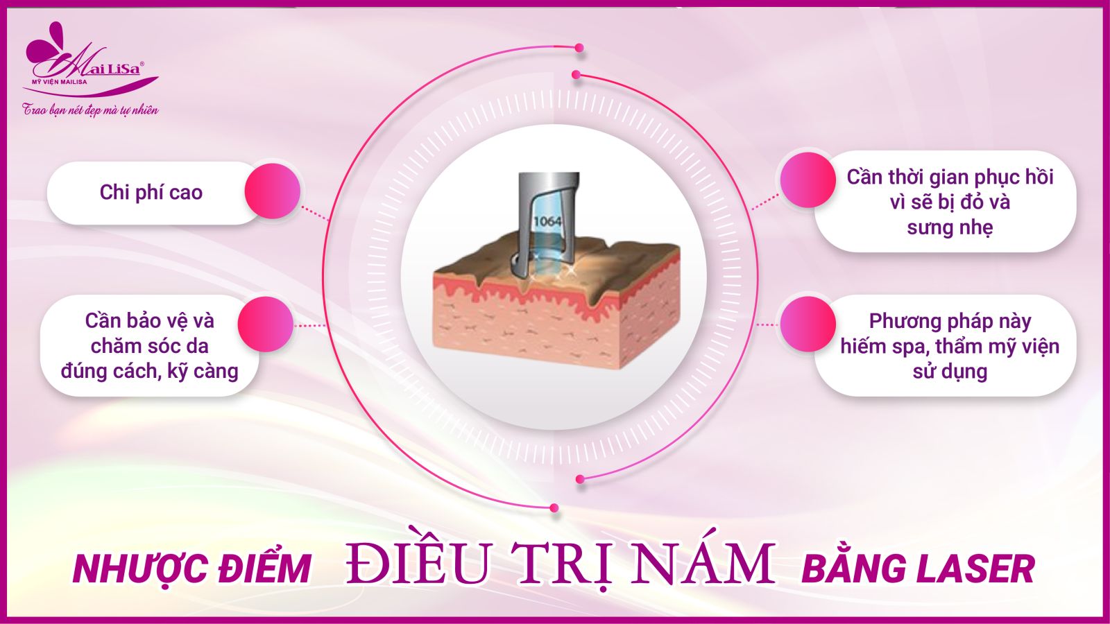 Bắn laser trị nám Whiteskin spectra có tốt không? Chi phí 2023 Nhược điểm điều trị nám bằng Laser