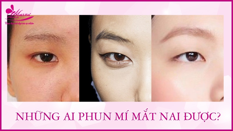 Mắt nai là gì? Tướng số người mắt nai sẽ như thế nào Những ai phun mí mắt nai được