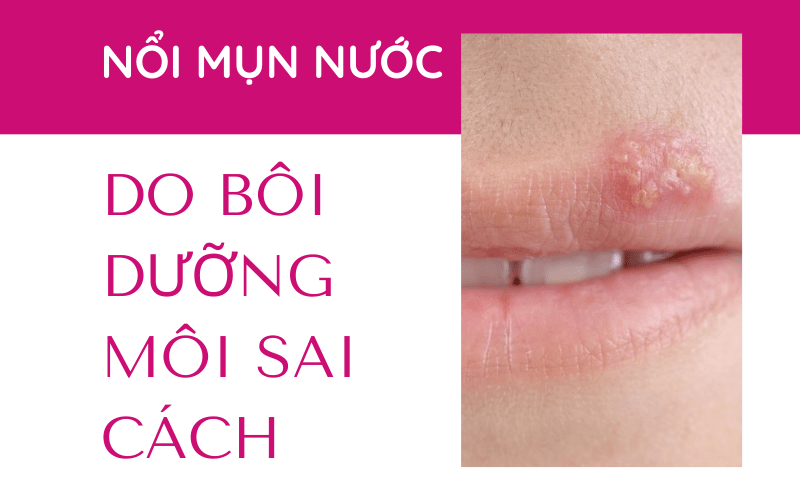 Mụn nước ở môi sau khi phun xăm có nguy hiểm không? Nên uống thuốc gì? môi bị nổi mụn nhỏ do dùng dưỡng môi sai cách