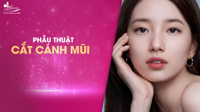 Cuốn cánh mũi bao nhiêu tiền? Bảng giá mới nhất 2024 5 - 5 cuốn cánh mũi bao nhiêu tiền phau thuat cat canh mui