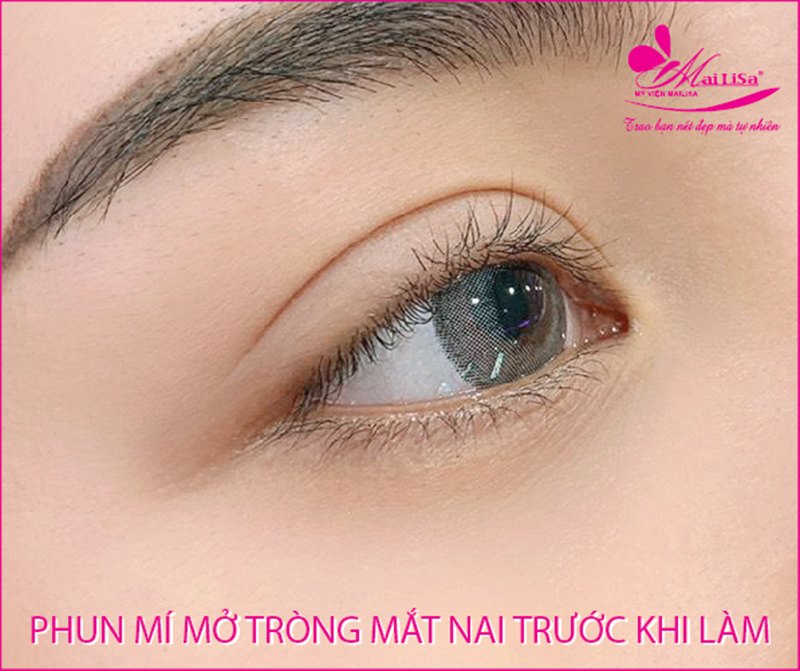Phun mí mở tròng mắt nai giúp đôi mắt có hồn đẹp tự nhiên 2022 hình ảnh phun mí mở tròng