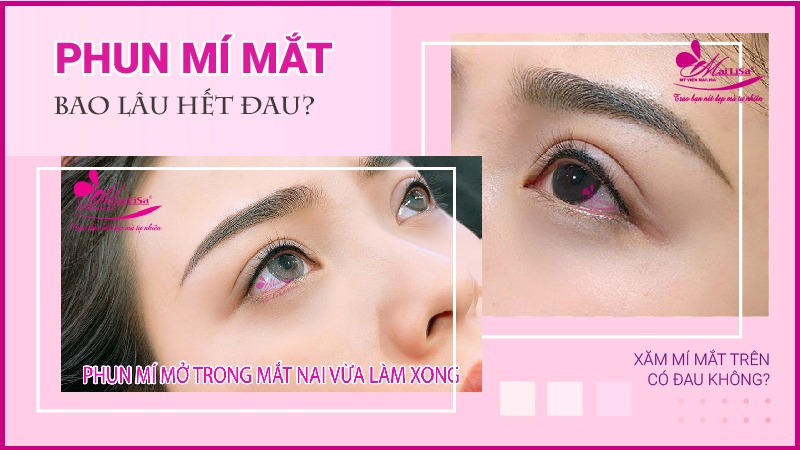 Phun mí mắt có đau không? Những lưu ý cần biết khi phun mí mắt xăm mí mắt