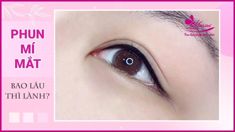 Phun mí mắt có đau không? Những lưu ý cần biết khi phun mí mắt phun mí mắt đẹp