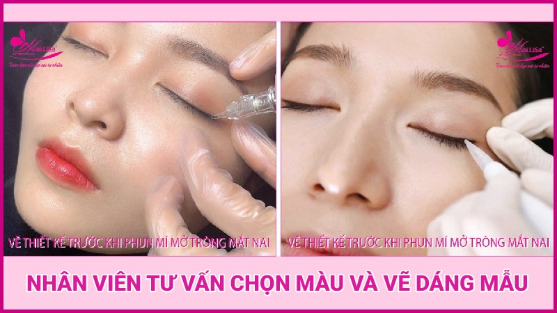 Phun mí mắt có đau không? Những lưu ý cần biết khi phun mí mắt phun mí mở tròng có già không