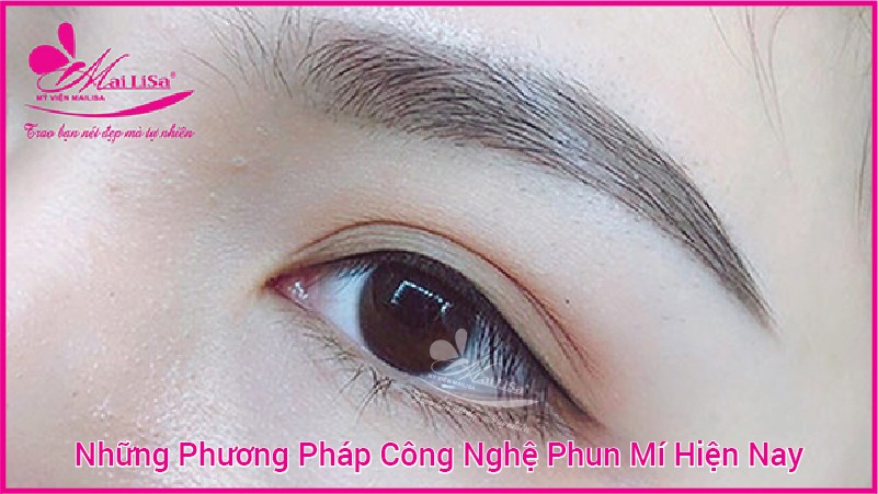 Phun mí mở tròng mắt nai giúp đôi mắt có hồn đẹp tự nhiên 2022 phun mí mắt tự nhiên