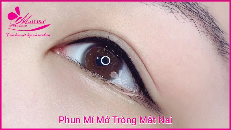 Phun mí mở tròng mắt nai giúp đôi mắt có hồn đẹp tự nhiên 2022 phun mí mở tròng được bao lâu