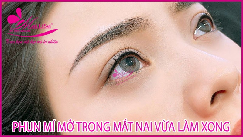 Phun mí mắt có đau không? Những lưu ý cần biết khi phun mí mắt có nên phun mí mở tròng