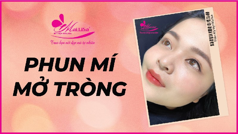 Phun mí mở tròng mắt nai giúp đôi mắt có hồn đẹp tự nhiên 2022 phun mí mở tròng mắt