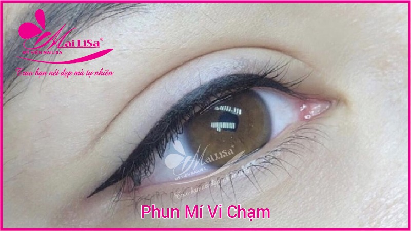 Phun mí mở tròng mắt nai giúp đôi mắt có hồn đẹp tự nhiên 2022 mí mắt đẹp