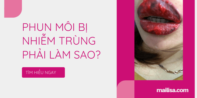 Phun môi bị hỏng, thất bại và nhiễm trùng thì phải làm sao? Cách khắc phục xăm môi bị nhiễm trùng