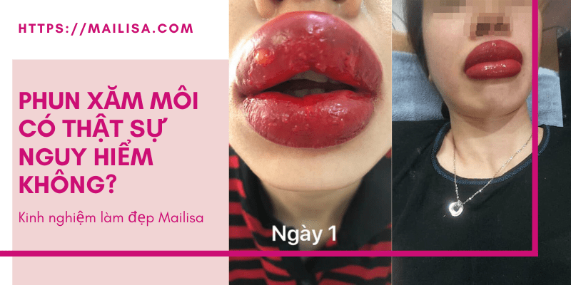 Tác hại của việc phun xăm môi tại địa chỉ KHÔNG UY TÍN năm 2021 phun môi có hại không