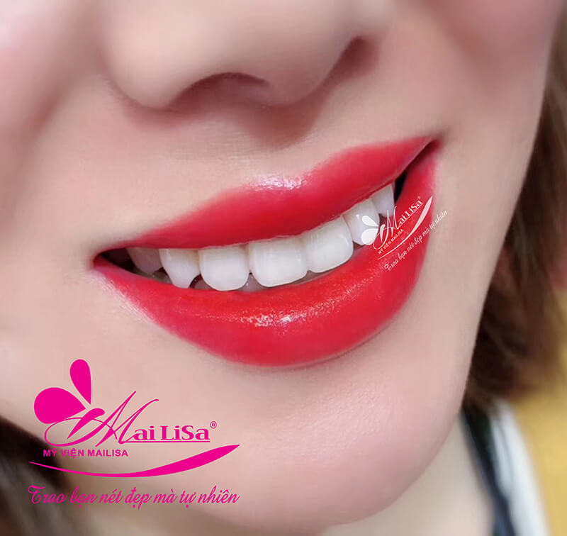 Vì sao phun môi, phun mày, phun mí tại thẩm mỹ viện Mailisa luôn đông khách? Vì sao phun môi, phun mày, phun mí tại thẩm mỹ viện Mailisa luôn đông khách?