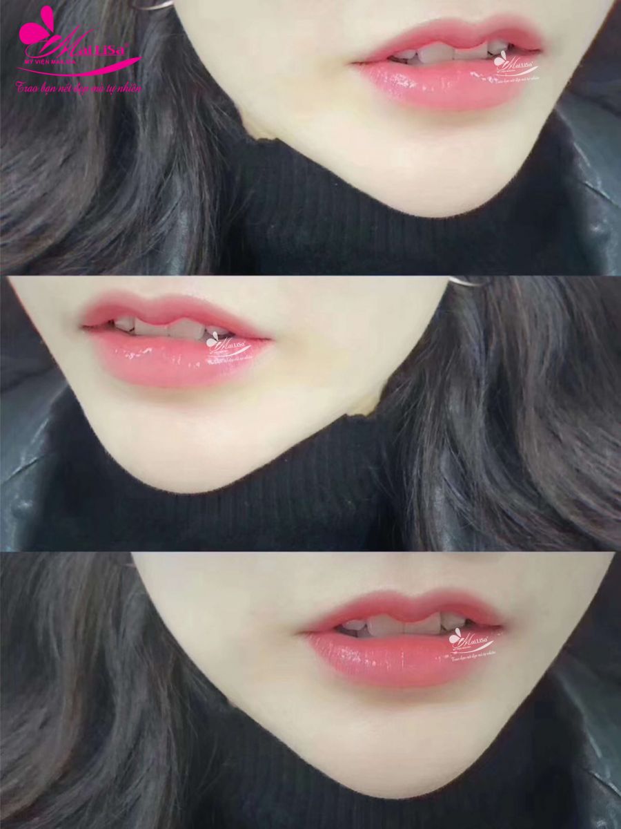 PHUN MÔI COLLAGEN PHỦ BÓNG PHUN MÔI COLLAGEN PHỦ BÓNG