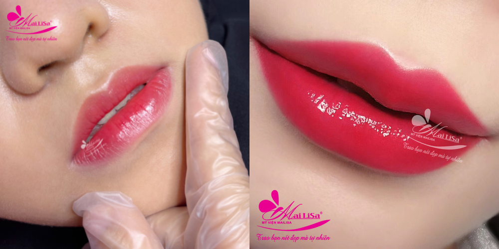 Dịch vụ phun mày, môi, mí tại thẩm mỹ viện Mailisa Dịch vụ phun mày, môi, mí tại thẩm mỹ viện Mailisa