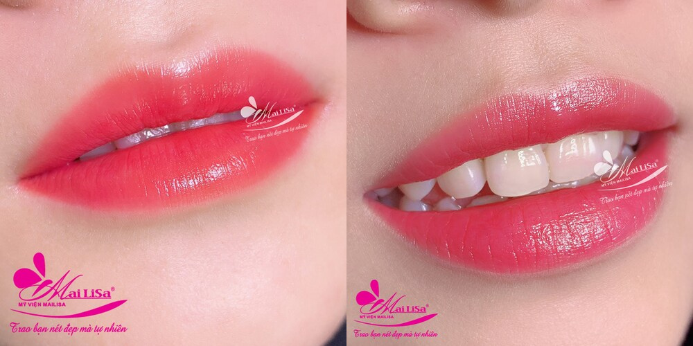 Dịch vụ phun mày, môi, mí tại thẩm mỹ viện Mailisa Dịch vụ phun mày, môi, mí tại thẩm mỹ viện Mailisa