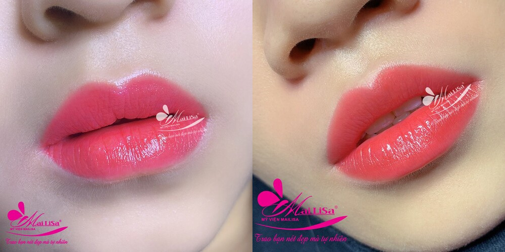 Dịch vụ phun mày, môi, mí tại thẩm mỹ viện Mailisa Dịch vụ phun mày, môi, mí tại thẩm mỹ viện Mailisa