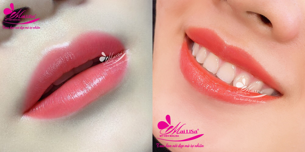 Dịch vụ phun mày, môi, mí tại thẩm mỹ viện Mailisa Dịch vụ phun mày, môi, mí tại thẩm mỹ viện Mailisa