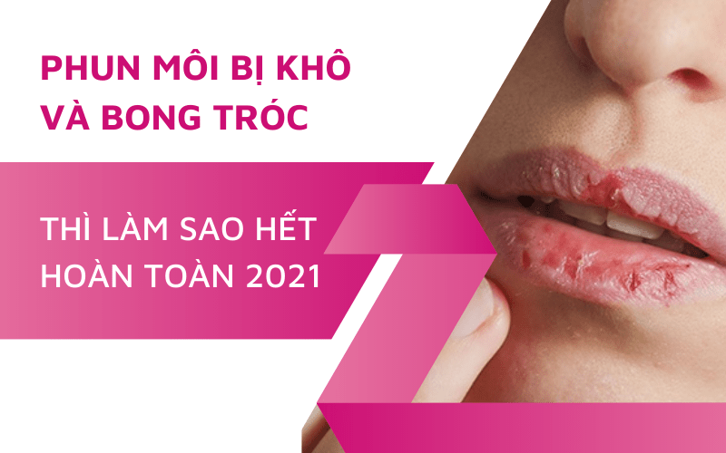 Phun môi bị khô bong tróc phải làm sao hết 2021 phun môi bị khô phải làm sao
