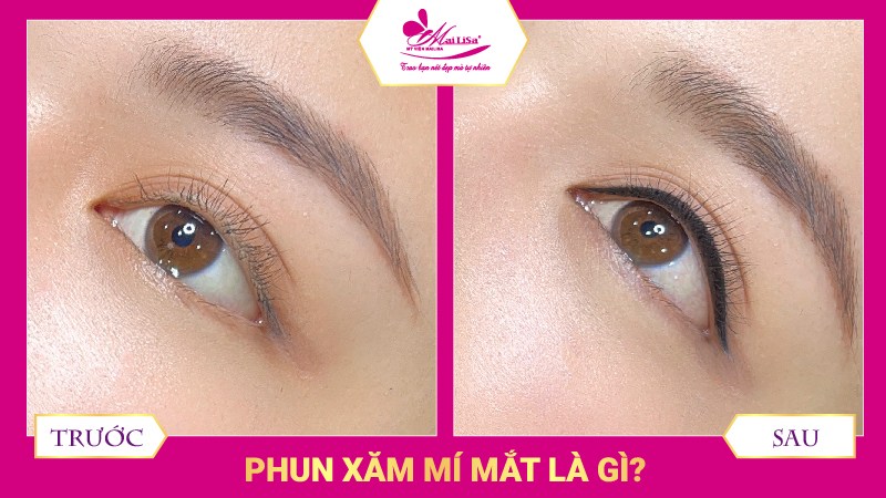 Phun mí mắt có đau không? Những lưu ý cần biết khi phun mí mắt phun mí mở tròng