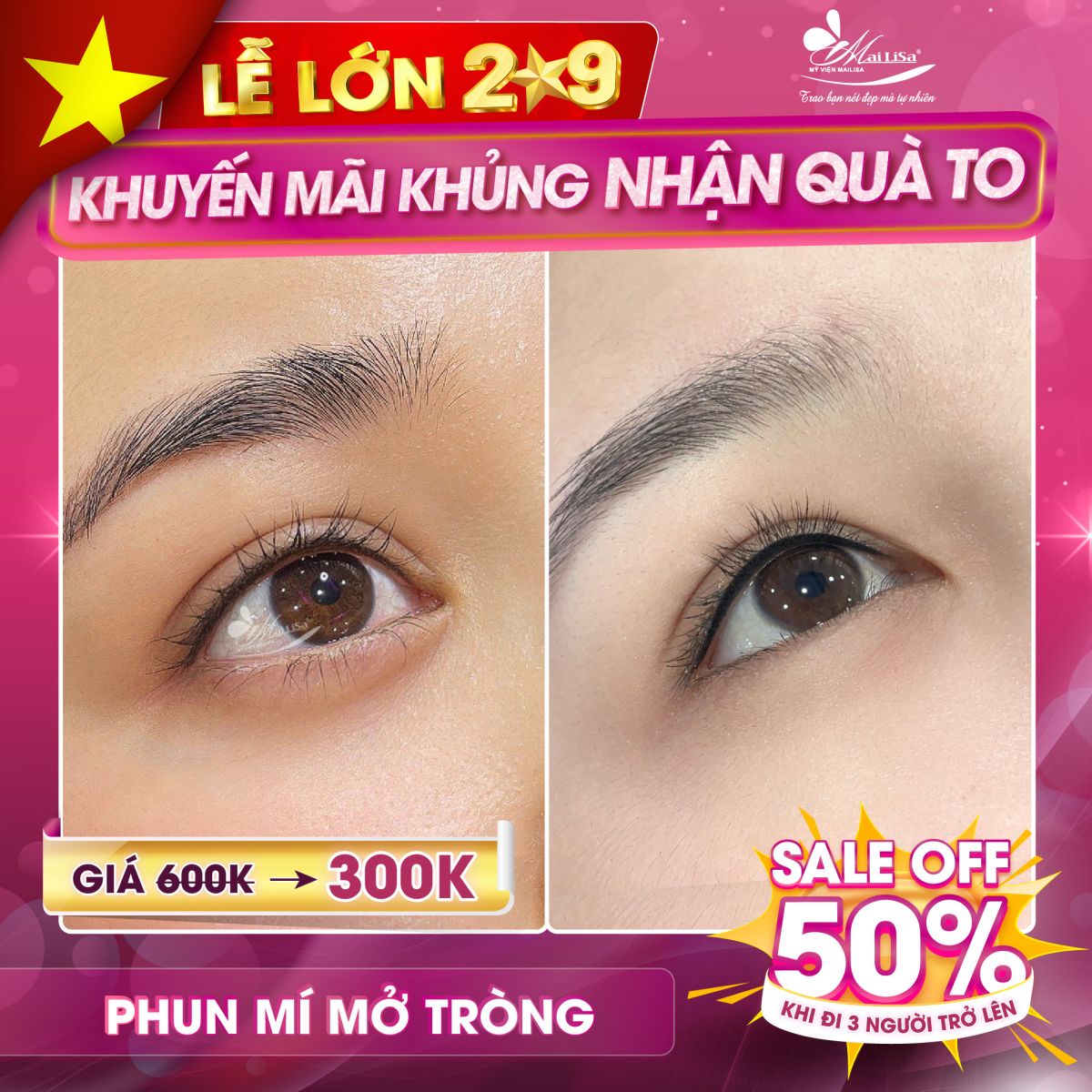 SĂN SALE KHỦNG phun mí mở tròng