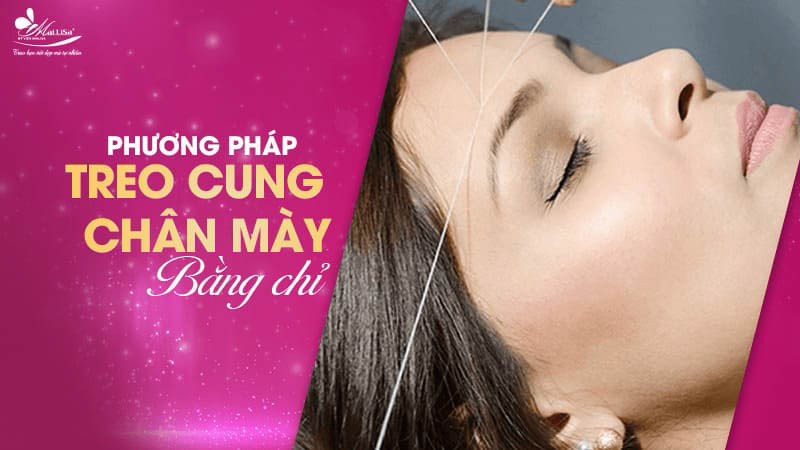 Treo chân mày là gì và có những phương pháp nào năm 2024 5 - 5 treo chân mày phuong phap treo khung chan may bang chi