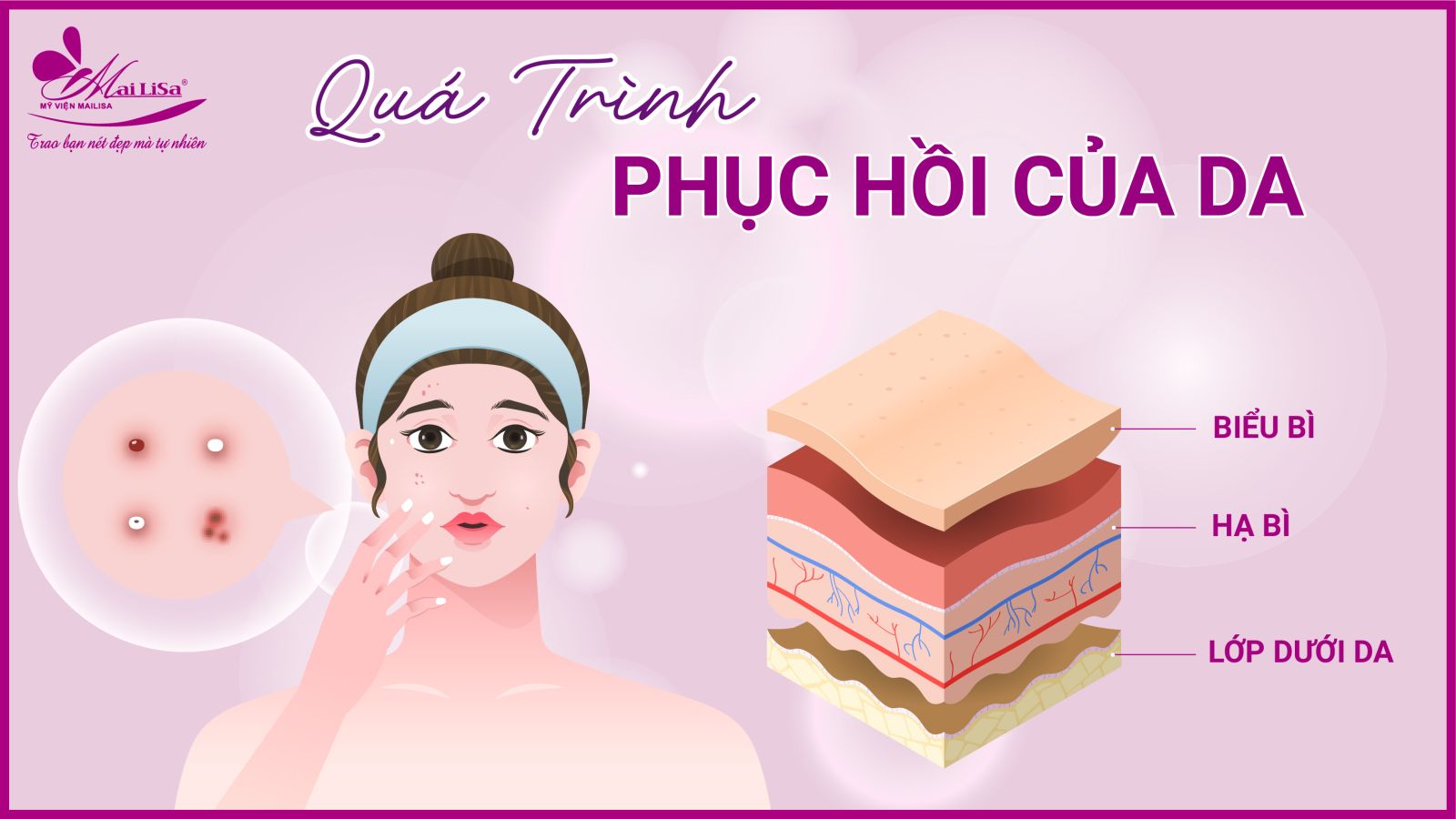 Bắn laser trị nám Whiteskin spectra có tốt không? Chi phí 2023 quá trình phục hồi của da