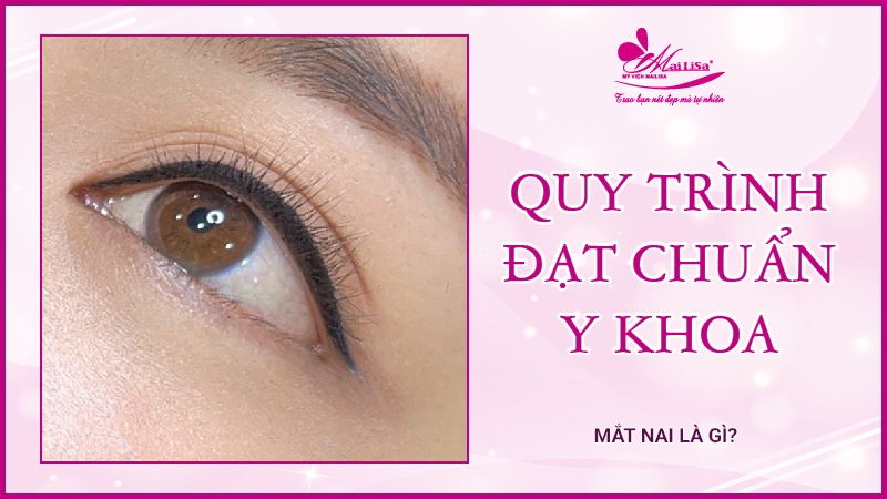 Mắt nai là gì? Tướng số người mắt nai sẽ như thế nào Quy trình đạt chuẩn y khoa