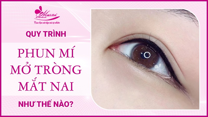 Mắt nai là gì? Tướng số người mắt nai sẽ như thế nào Quy trình phun mí mắt nai như nào