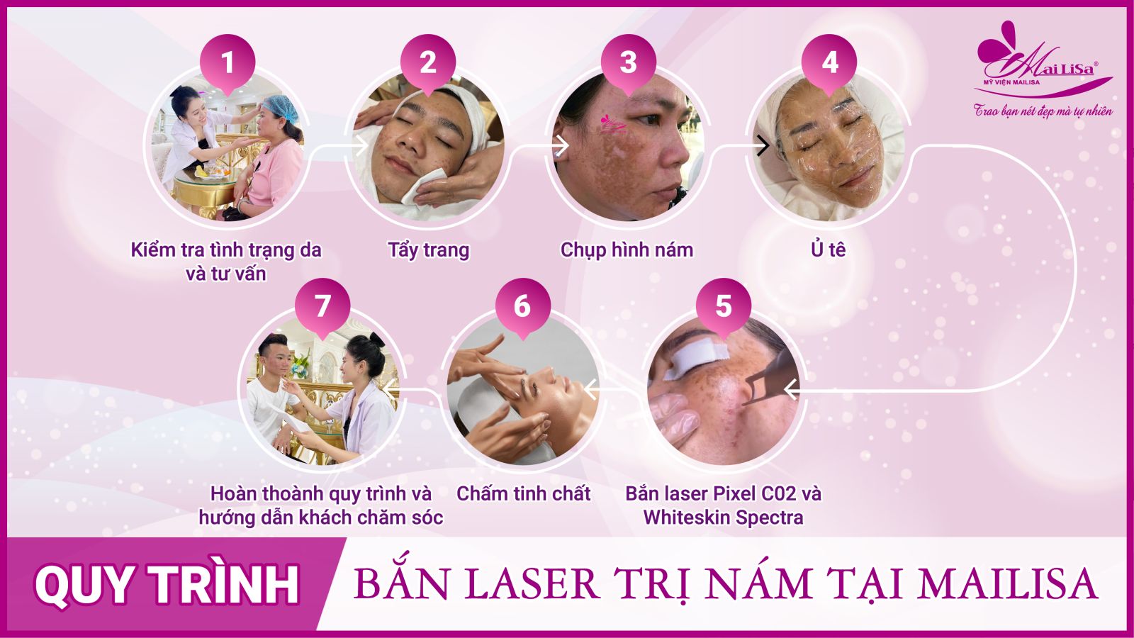 Bắn laser trị nám Whiteskin spectra có tốt không? Chi phí 2023 Bắn laser trị nám Whiteskin spectra có tốt không? Chi phí 2023