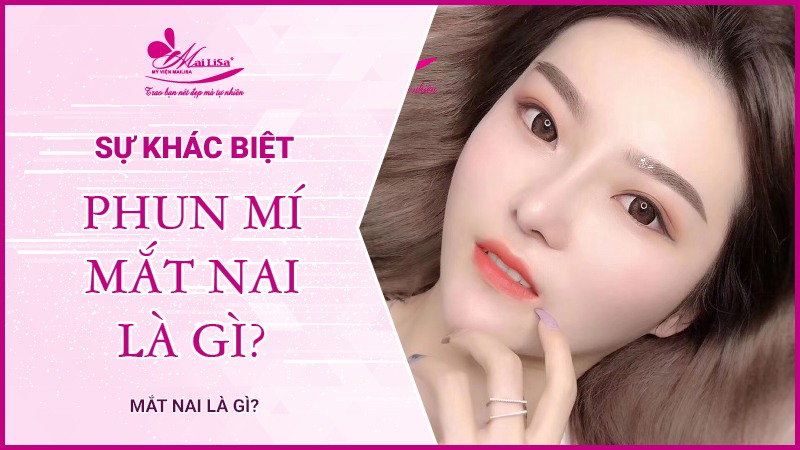 Mắt nai là gì? Tướng số người mắt nai sẽ như thế nào Sự khác biệt mắt nai là gì