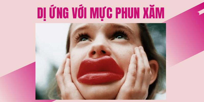Tác hại của việc phun xăm môi tại địa chỉ KHÔNG UY TÍN năm 2021 tác hại của xăm môi