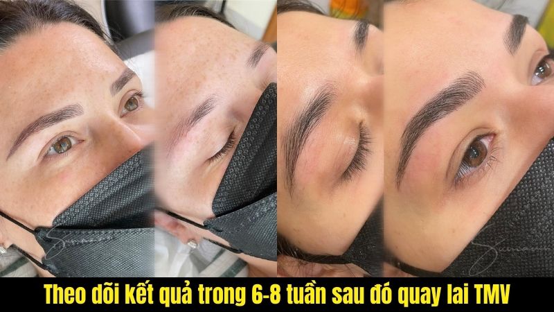 Lông mày điêu khắc là gì? RỦI RO khi điêu khắc chân mày nam nữ Theo dõi kết quả lông mày điêu khắc