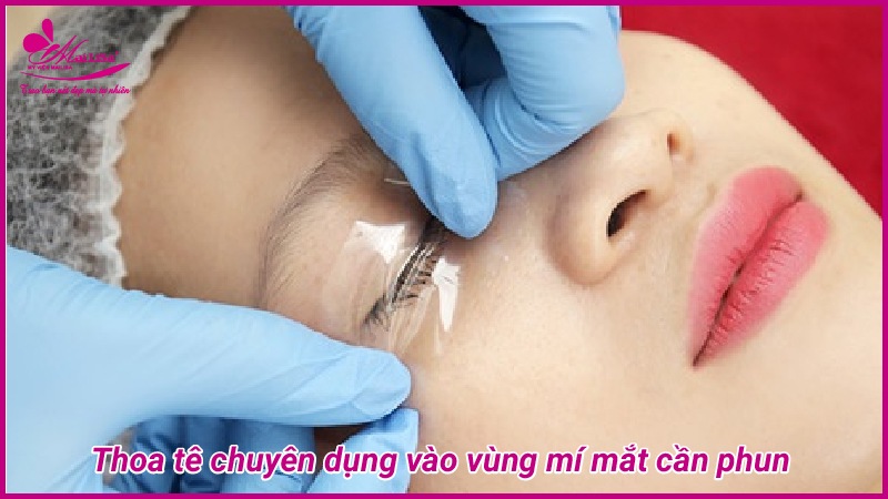 Mắt nai là gì? Tướng số người mắt nai sẽ như thế nào Thoa tê chuyên dụng