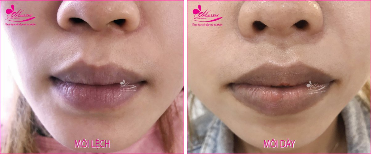 Tạo môi trái tim Hàn Quốc Tạo môi trái tim Hàn Quốc