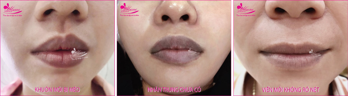 Tạo môi trái tim Hàn Quốc Tạo môi trái tim Hàn Quốc