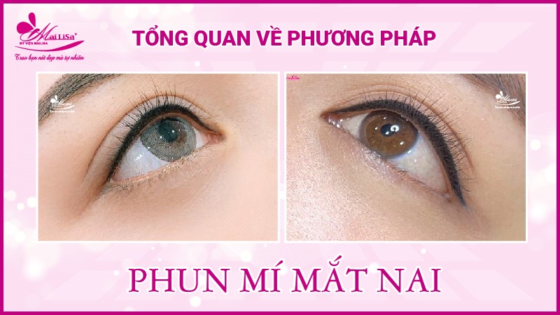 Mắt nai là gì? Tướng số người mắt nai sẽ như thế nào Tổng quan phun mí mắt nai