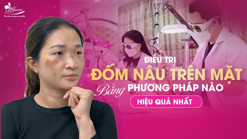 8 Cách trị đốm nâu trên mặt thịnh hành hiện nay 16 - 16 đốm nâu trên mặt tren da co dam doi mau nau