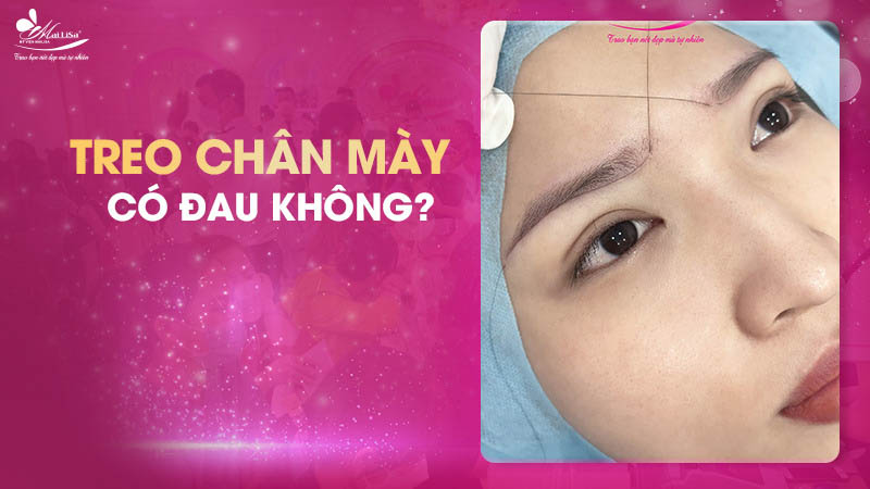 Treo chân mày là gì và có những phương pháp nào năm 2024 11 - 11 treo chân mày treo chan may co dau khong