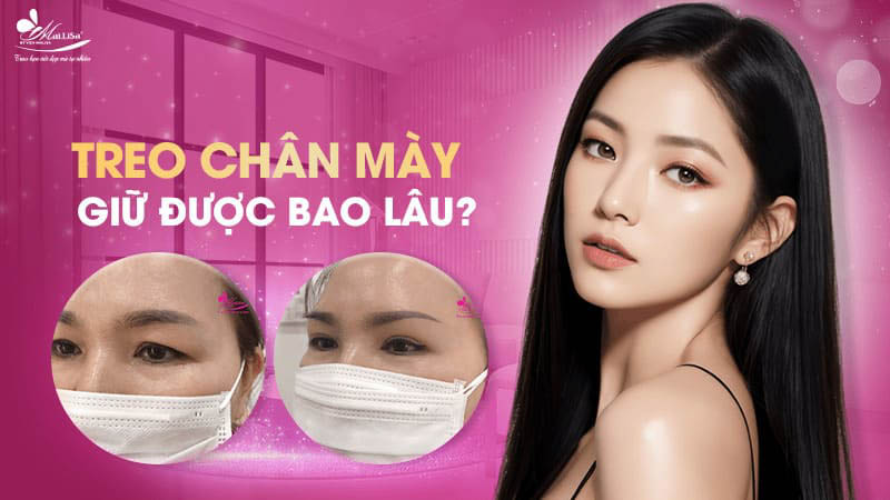 Treo chân mày là gì và có những phương pháp nào năm 2024 10 - 10 treo chân mày treo chan may giu duoc bao lau