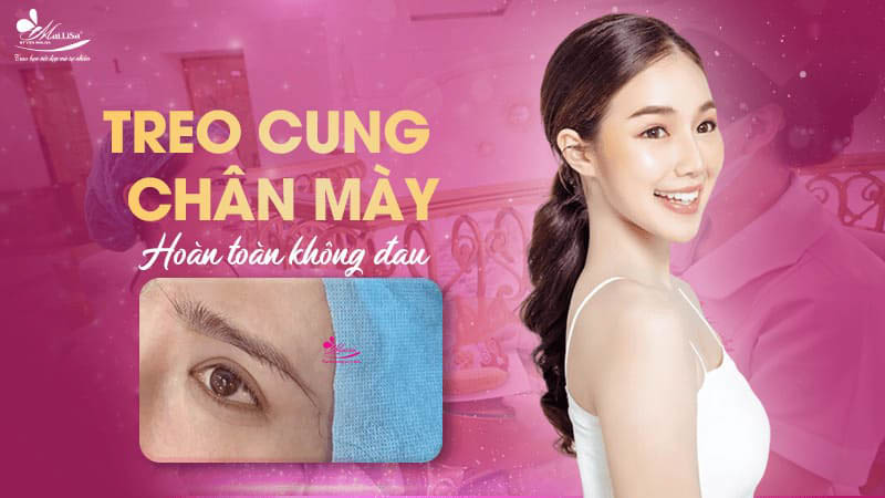 Treo chân mày là gì và có những phương pháp nào năm 2024 12 - 12 treo chân mày treo cung chan may hoan toan khong dau