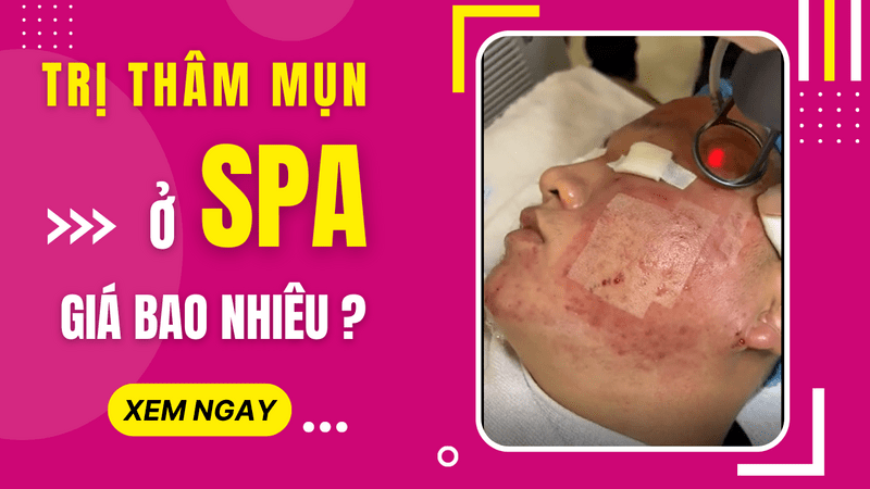 Bảng giá dịch vụ trị thâm mụn ở spa giá bao nhiêu 2022? trị thâm mụn spa giá bao nhiêu