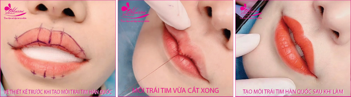 Tạo môi trái tim Hàn Quốc Tạo môi trái tim Hàn Quốc