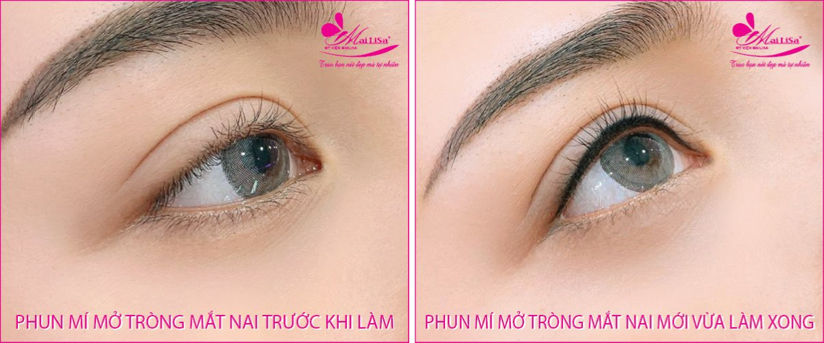 Phun mí mở tròng mắt nai Phun mí mở tròng mắt nai